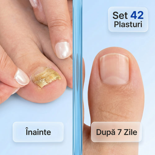 Set 42 Plasturi Antifungici UnghiiLibere™